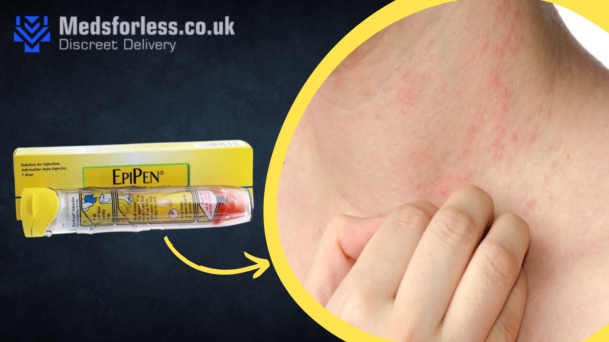 Can Epipens Treat All Types of Allergic Reactions? Meds For Less