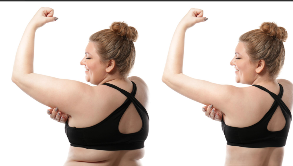 semaglutide weight loss injection pen