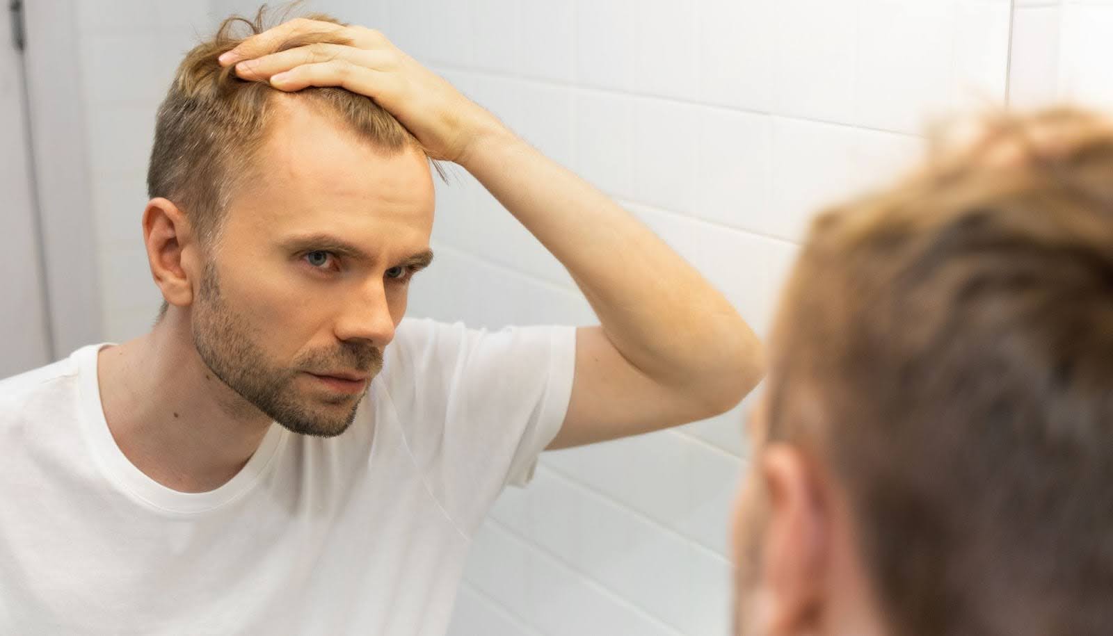 best hair growth supplements for women and men