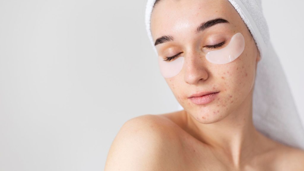 acneic skin treatment
