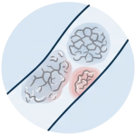 Medications Eczema & Psoriasis