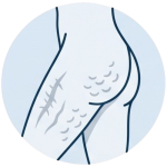 Medications for Scars and Cellulite