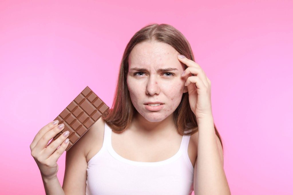 foods that can cause acne breakouts